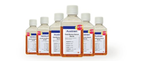 培养液中酵母菌种群数量的变化,关于“探究培养液中酵母菌种群数量的变化”实验，下列说法...