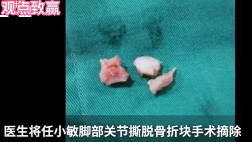 女生被罚下蹲致残调解协议达成,泸州女生被罚150个下蹲致残，调解协议达成，受害人获得了怎样的赔偿？