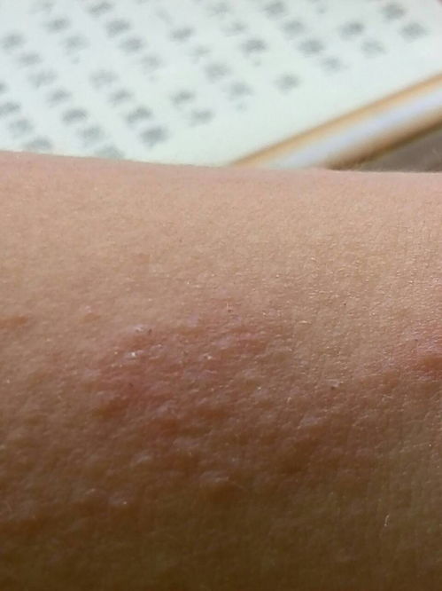 密密麻麻的意思,密密麻麻的意思