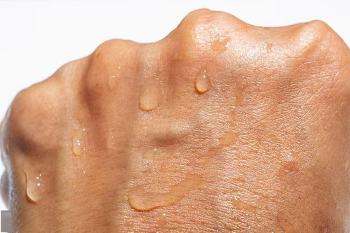 浓硫酸溅到皮肤上,浓硫酸沾到皮肤的处理方法化学