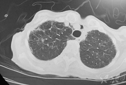 脉搏短绌,脉搏短促名词解释